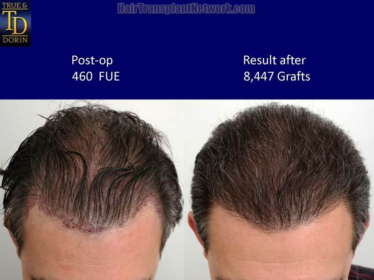 Name:  8447.jpg
Views: 99
Size:  88.8 KB